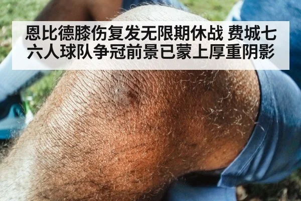 恩比德膝伤复发无限期休战 费城七六人球队争冠前景已蒙上厚重阴影